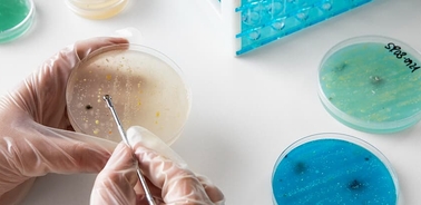 A researcher is working with petri dishes and a pipette in a laboratory setting.