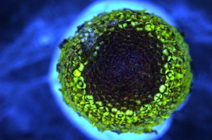 A close-up view of a colorful pollen grain under blue lighting.