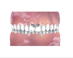 Luxury Problems: Dental Cosmetics/Clinics