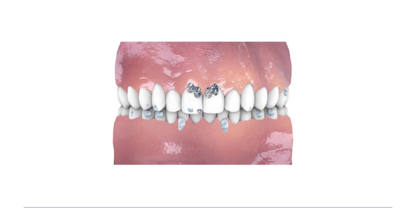 Luxury Problems: Dental Cosmetics/Clinics